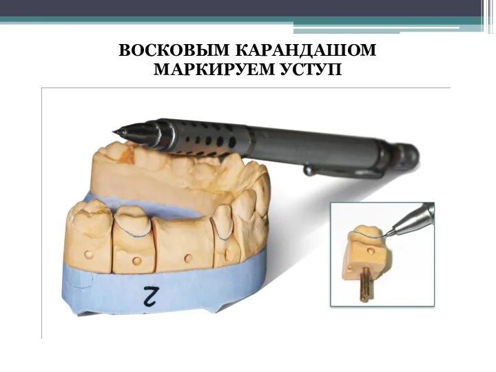 ВОСКОВЫМ КАРАНДАШОМ МАРКИРУЕМ УСТУП