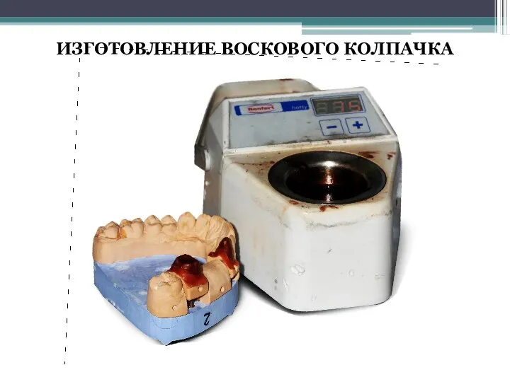 ИЗГОТОВЛЕНИЕ ВОСКОВОГО КОЛПАЧКА