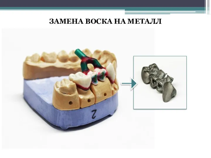 ЗАМЕНА ВОСКА НА МЕТАЛЛ