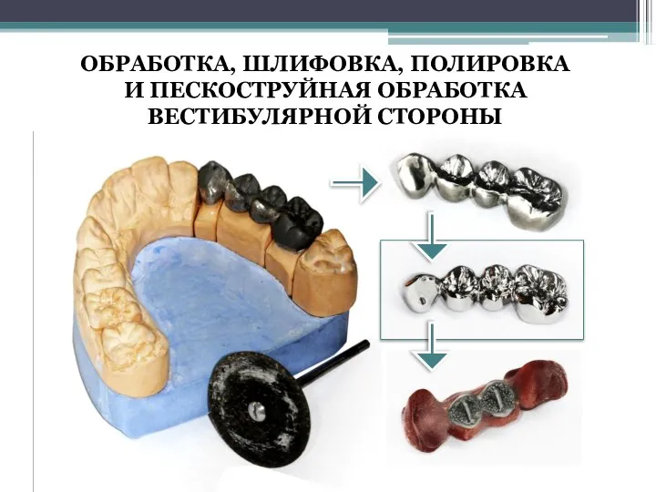 ОБРАБОТКА, ШЛИФОВКА, ПОЛИРОВКА И ПЕСКОСТРУЙНАЯ ОБРАБОТКА ВЕСТИБУЛЯРНОЙ СТОРОНЫ