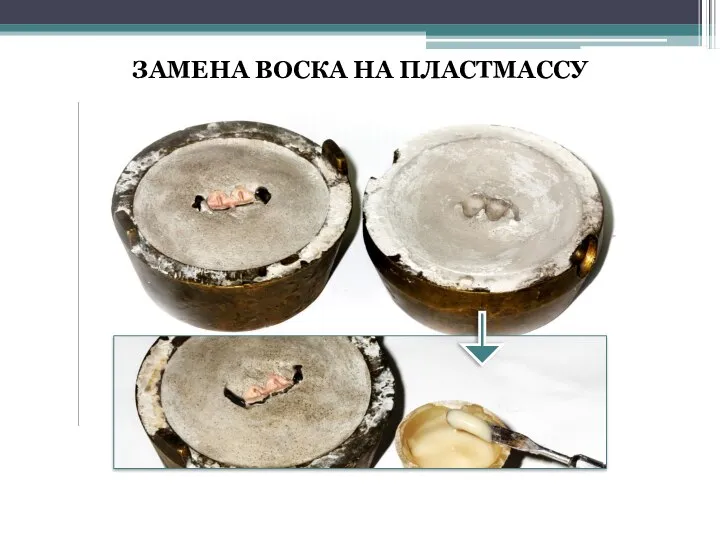 ЗАМЕНА ВОСКА НА ПЛАСТМАССУ