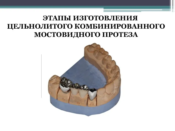 ЭТАПЫ ИЗГОТОВЛЕНИЯ ЦЕЛЬНОЛИТОГО КОМБИНИРОВАННОГО МОСТОВИДНОГО ПРОТЕЗА