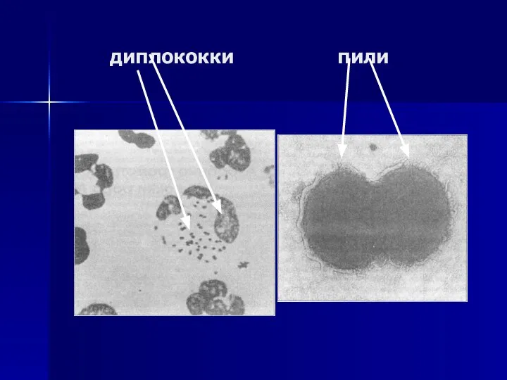 диплококки пили