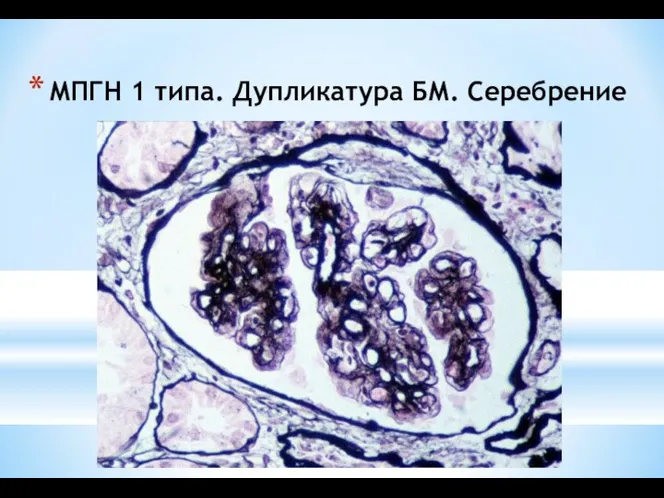 МПГН 1 типа. Дупликатура БМ. Серебрение