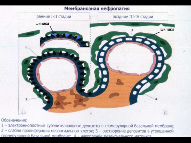 шипики шипики