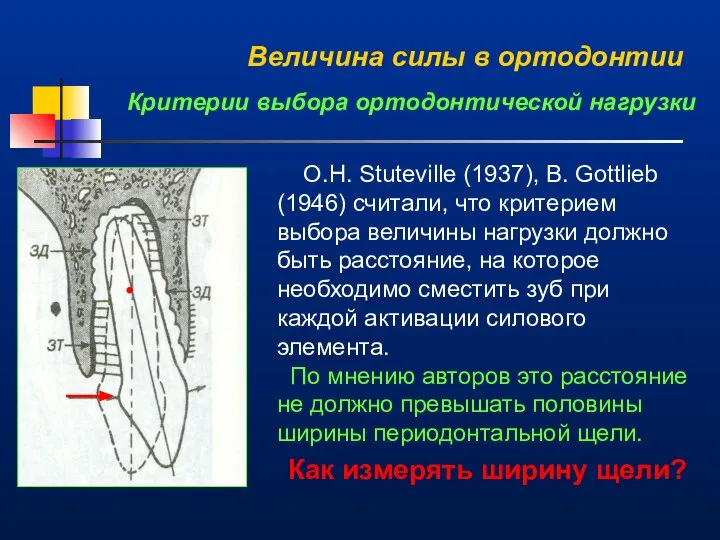 Величина силы в ортодонтии Критерии выбора ортодонтической нагрузки O.H. Stuteville (1937),