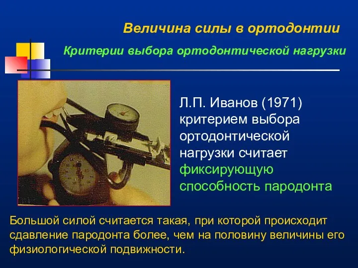 Величина силы в ортодонтии Критерии выбора ортодонтической нагрузки Л.П. Иванов (1971)