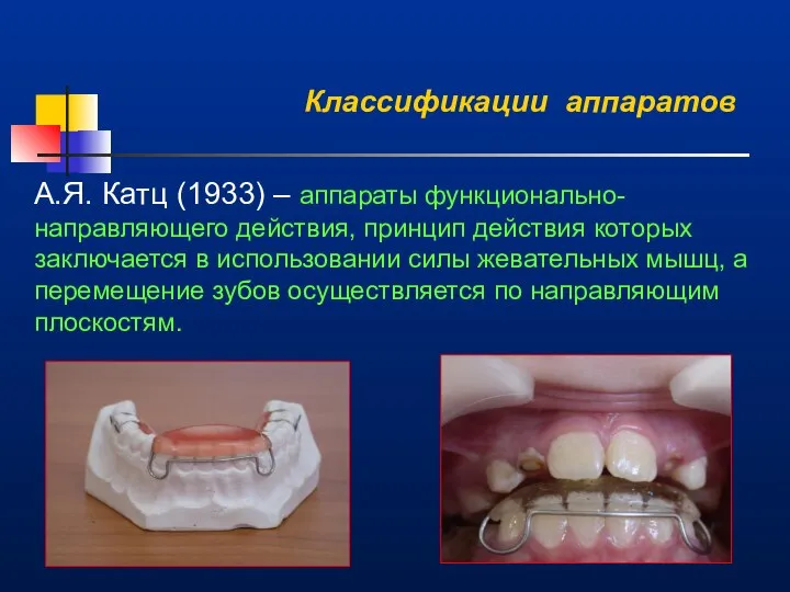 Классификации аппаратов А.Я. Катц (1933) – аппараты функционально-направляющего действия, принцип действия