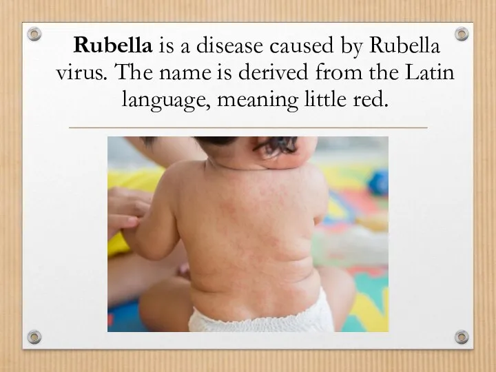 Rubella is a disease caused by Rubella virus. The name is