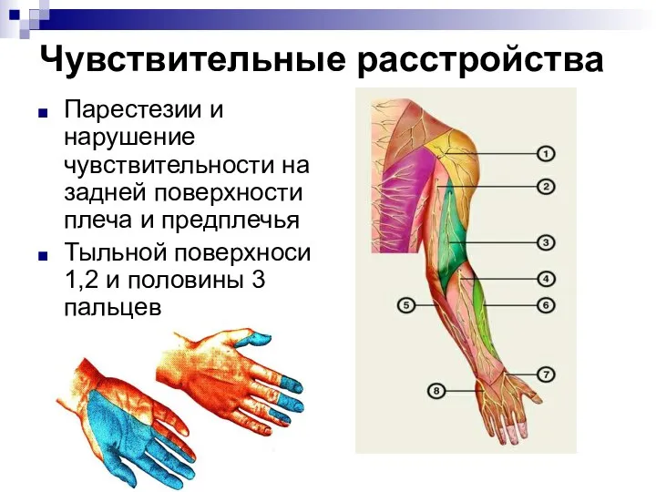 Чувствительные расстройства Парестезии и нарушение чувствительности на задней поверхности плеча и