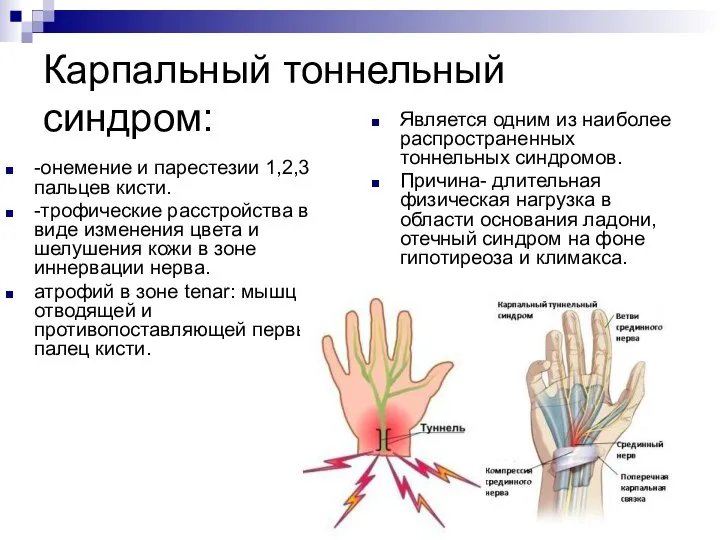 Карпальный тоннельный синдром: -онемение и парестезии 1,2,3 пальцев кисти. -трофические расстройства