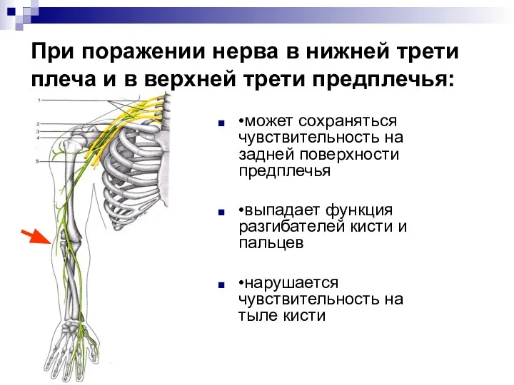 При поражении нерва в нижней трети плеча и в верхней трети