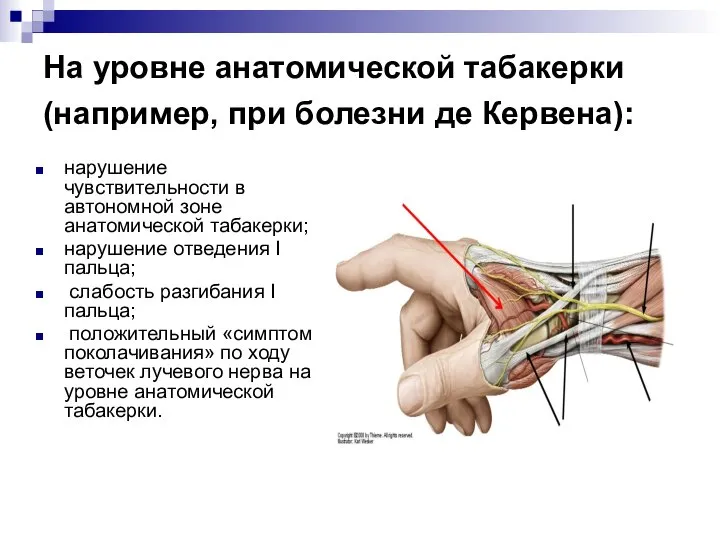 На уровне анатомической табакерки (например, при болезни де Кервена): нарушение чувствительности