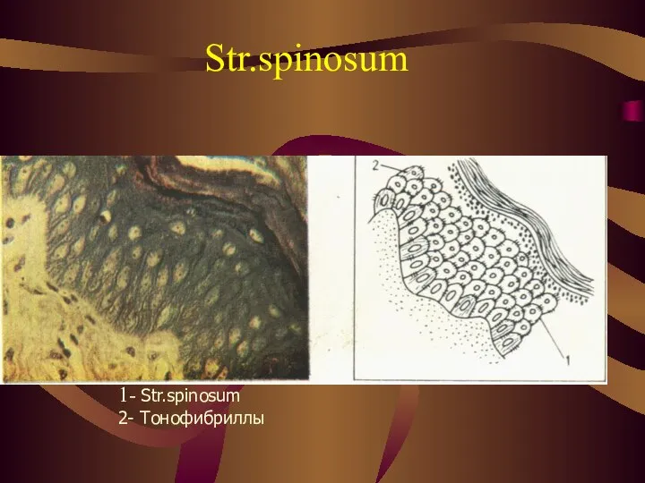 Str.spinosum 1- Str.spinosum 2- Тонофибриллы