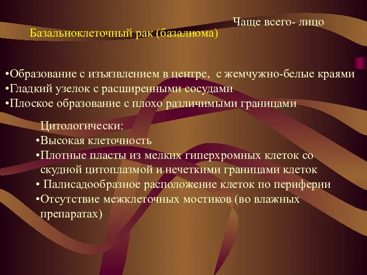 Базальноклеточный рак (базалиома) Образование с изъязвлением в центре, с жемчужно-белые краями