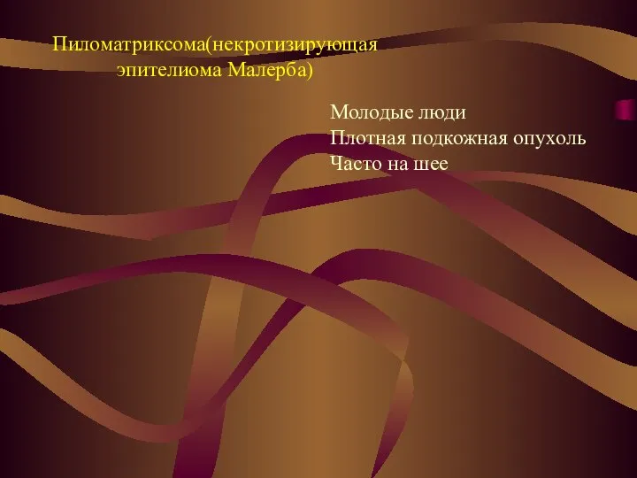 Пиломатриксома(некротизирующая эпителиома Малерба) Молодые люди Плотная подкожная опухоль Часто на шее