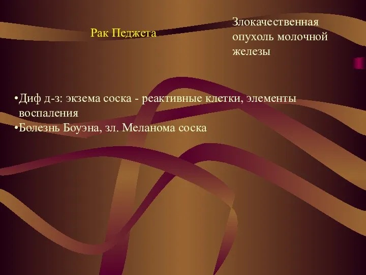 Рак Педжета Злокачественная опухоль молочной железы Диф д-з: экзема соска -