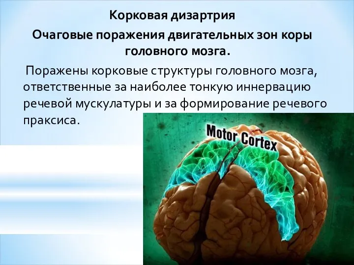 Корковая дизартрия Очаговые поражения двигательных зон коры головного мозга. Поражены корковые