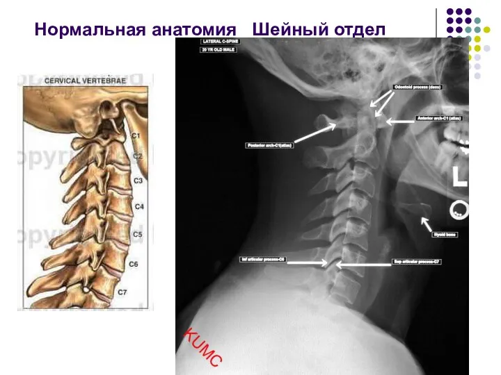 Нормальная анатомия Шейный отдел