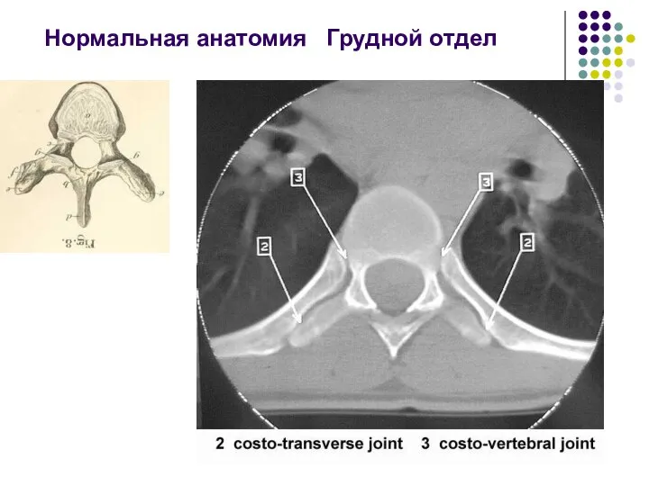 Нормальная анатомия Грудной отдел