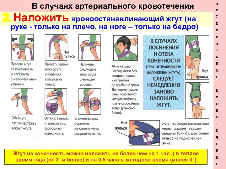 В случаях артериального кровотечения 2. Наложить кровоостанавливающий жгут (на руке -