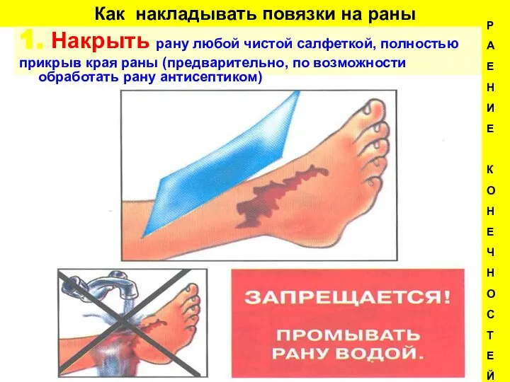 Как накладывать повязки на раны 1. Накрыть рану любой чистой салфеткой,