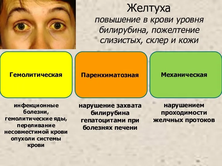 Желтуха повышение в крови уровня билирубина, пожелтение слизистых, склер и кожи