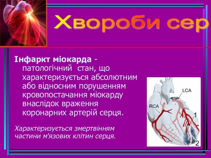 Хвороби серця Інфаркт міокарда - патологічний стан, що характеризується абсолютним або