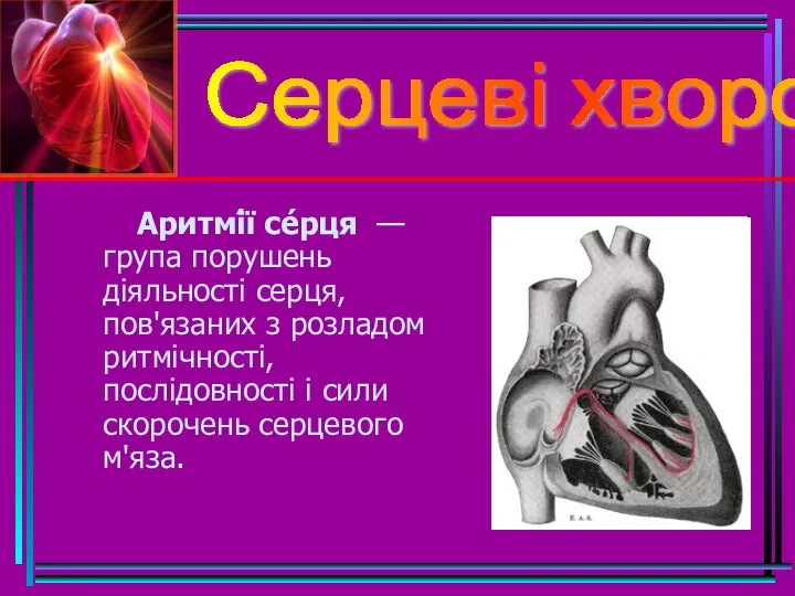 Серцеві хвороби Аритмі́ї се́рця — група порушень діяльності серця, пов'язаних з