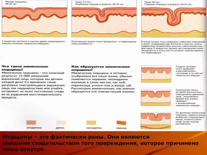 Морщины – это фактически раны. Они являются внешним свидетельством того повреждения,