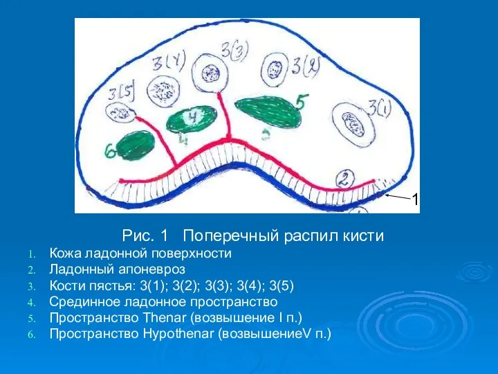 Рис. 1 Поперечный распил кисти Кожа ладонной поверхности Ладонный апоневроз Кости