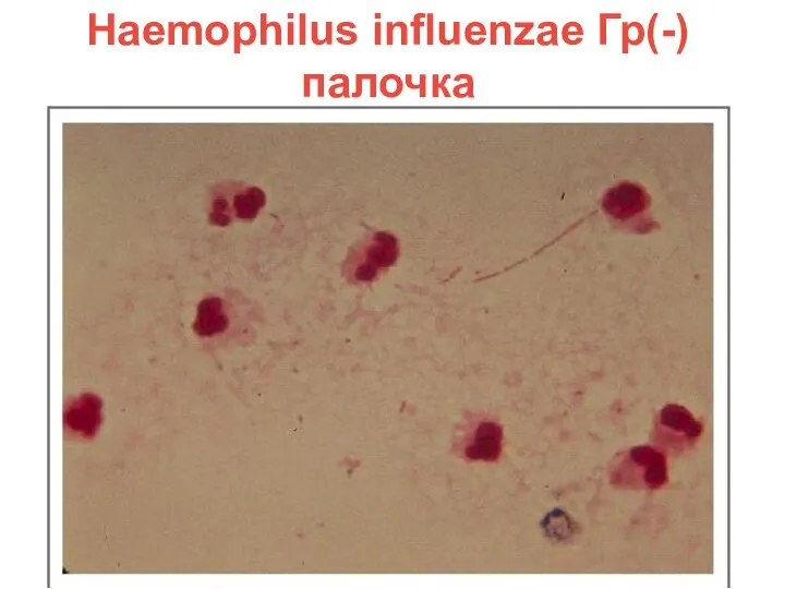 Haemophilus influenzae Гр(-) палочка
