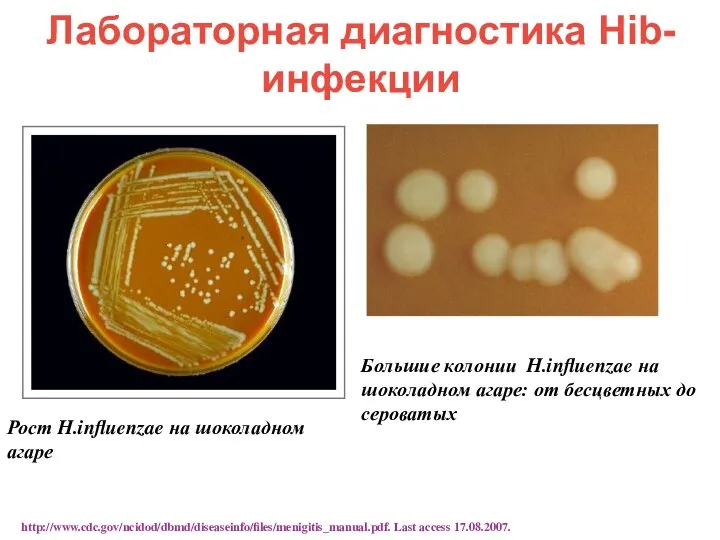 Лабораторная диагностика Hib-инфекции Рост H.influenzae на шоколадном агаре Большие колонии H.influenzae