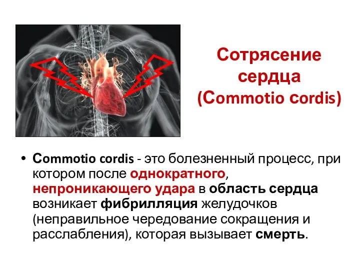Сотрясение сердца (Сommotio сordis) Сommotio cordis - это болезненный процесс, при