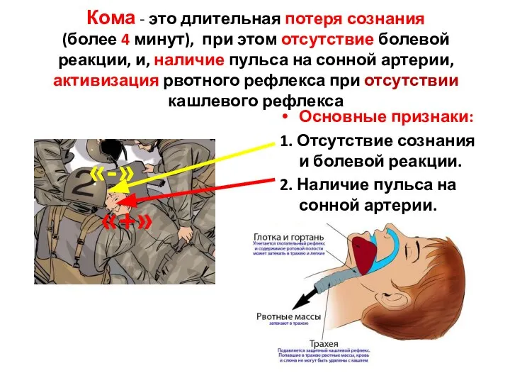 Кома - это длительная потеря сознания (более 4 минут), при этом