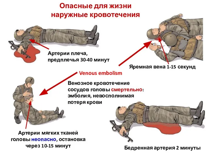 Опасные для жизни наружные кровотечения Артерии плеча, предплечья 30-40 минут Венозное