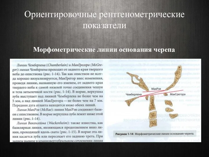 Ориентировочные рентгенометрические показатели Морфометрические линии основания черепа