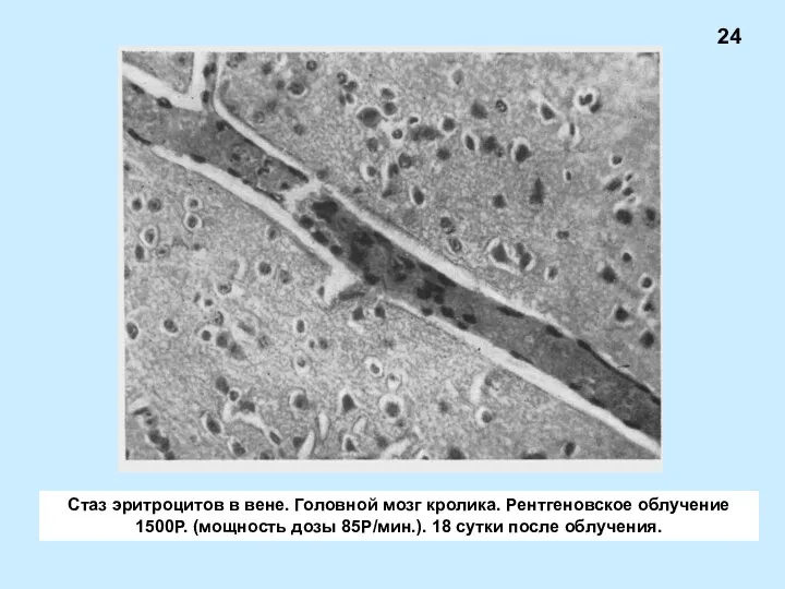 Стаз эритроцитов в вене. Головной мозг кролика. Рентгеновское облучение 1500Р. (мощность