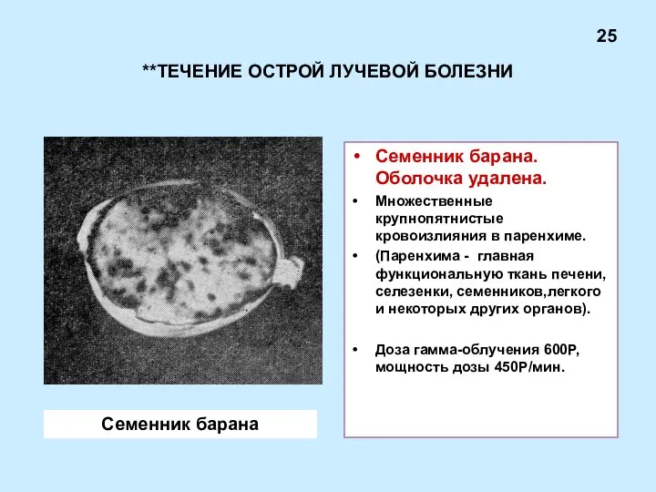 **ТЕЧЕНИЕ ОСТРОЙ ЛУЧЕВОЙ БОЛЕЗНИ Семенник барана. Оболочка удалена. Множественные крупнопятнистые кровоизлияния