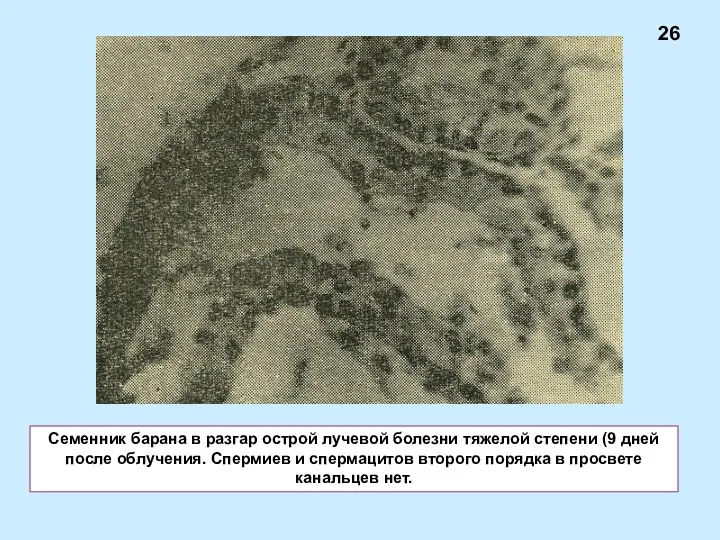 Семенник барана в разгар острой лучевой болезни тяжелой степени (9 дней