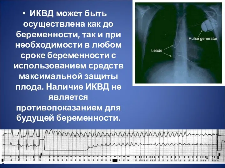 ИКВД может быть осуществлена как до беременности, так и при необходимости