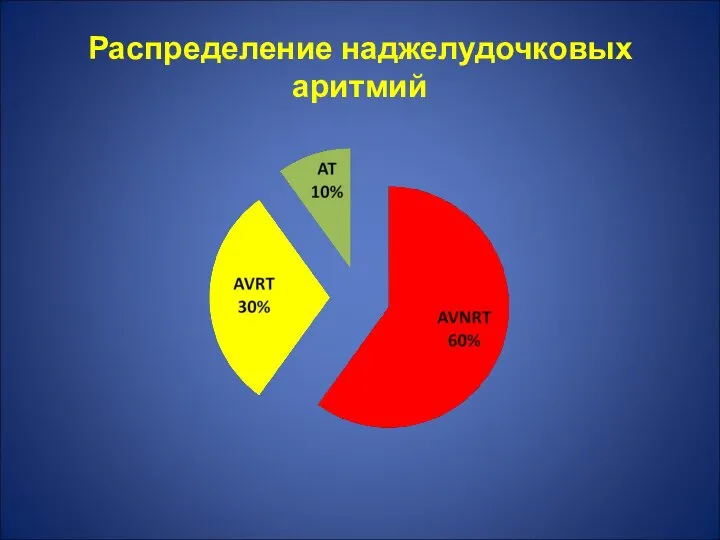 Распределение наджелудочковых аритмий