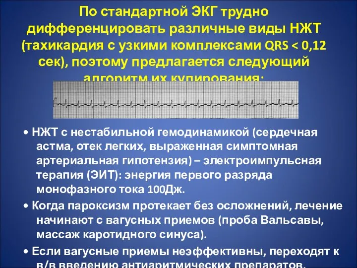 По стандартной ЭКГ трудно дифференцировать различные виды НЖТ (тахикардия с узкими