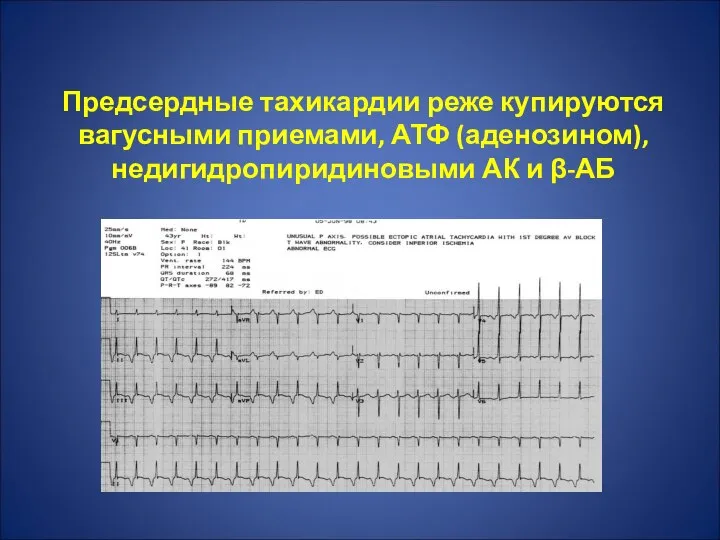 Предсердные тахикардии реже купируются вагусными приемами, АТФ (аденозином), недигидропиридиновыми АК и β-АБ