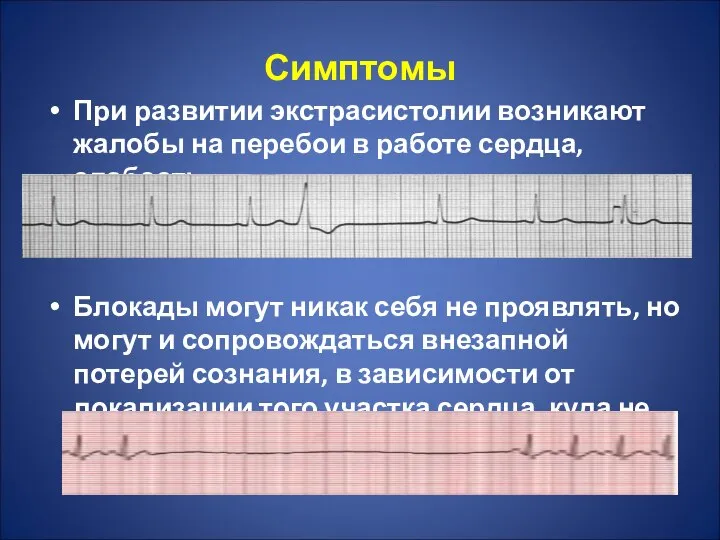 Симптомы При развитии экстрасистолии возникают жалобы на перебои в работе сердца,