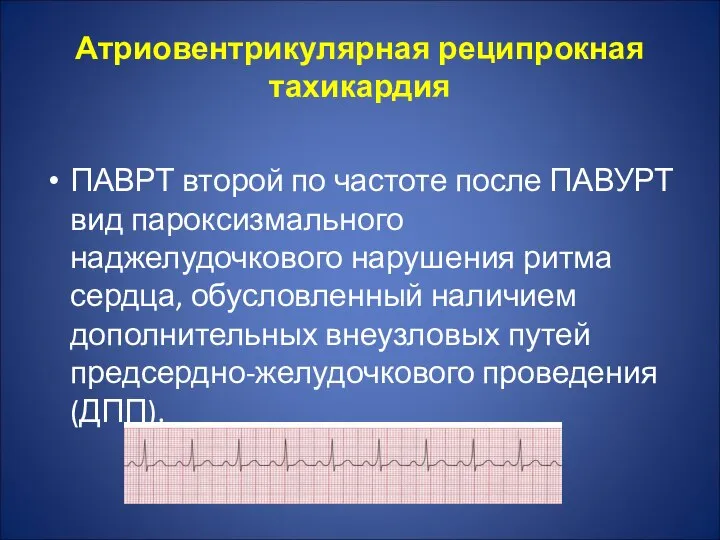 Атриовентрикулярная реципрокная тахикардия ПАВРТ второй по частоте после ПАВУРТ вид пароксизмального