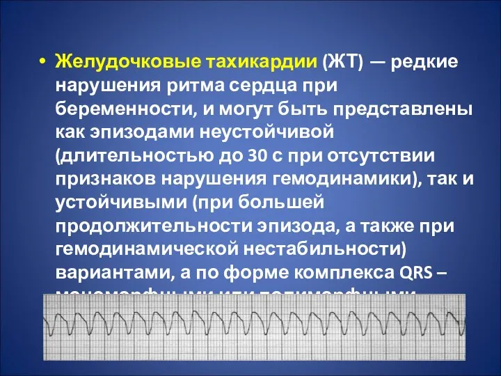 Желудочковые тахикардии (ЖТ) — редкие нарушения ритма сердца при беременности, и