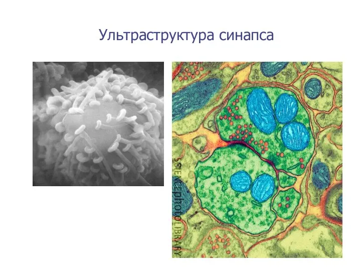 Ультраструктура синапса