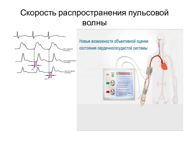 Скорость распространения пульсовой волны