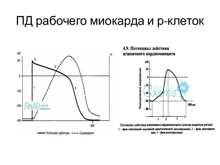 ПД рабочего миокарда и р-клеток